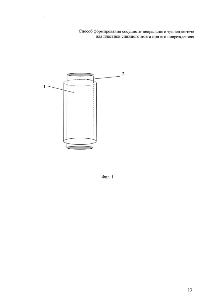 Способ формирования аутовенозно-неврального трансплантата для пластики спинного мозга при его повреждениях (патент 2622634)