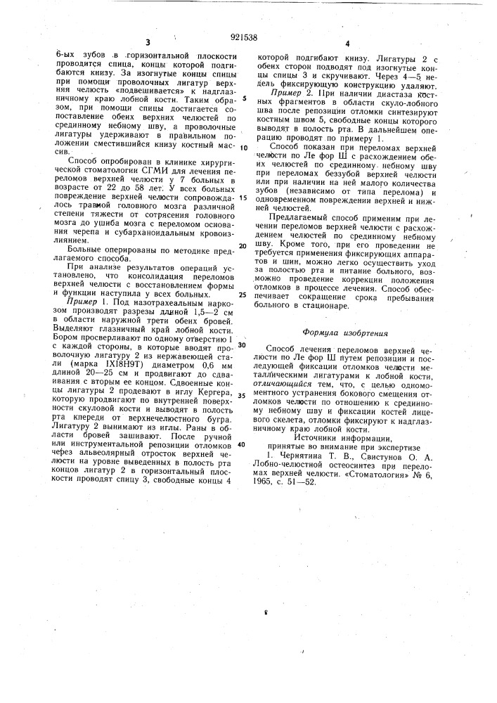 Способ лечения переломов верхней челюсти по ле фор ш (патент 921538)
