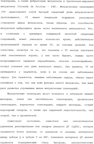 Применение ранолазина для изготовления лекарственного средства для лечения аритмий (патент 2325161)