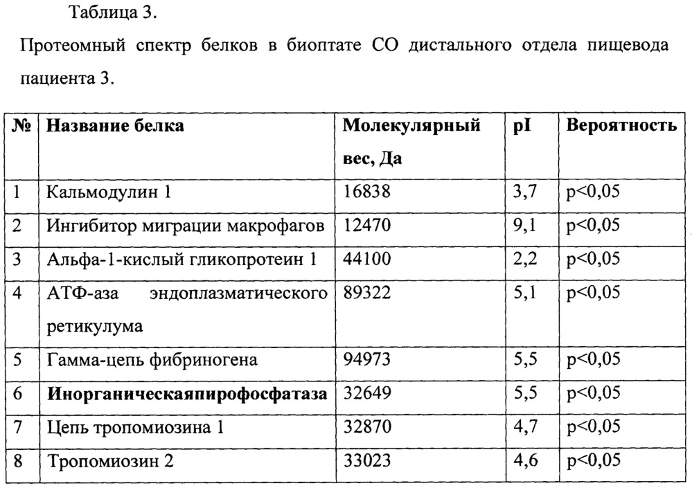 Способ диагностики пищевода барретта у больных с осложненным течением гастроэзофагеальной рефлюксной болезни (патент 2655807)