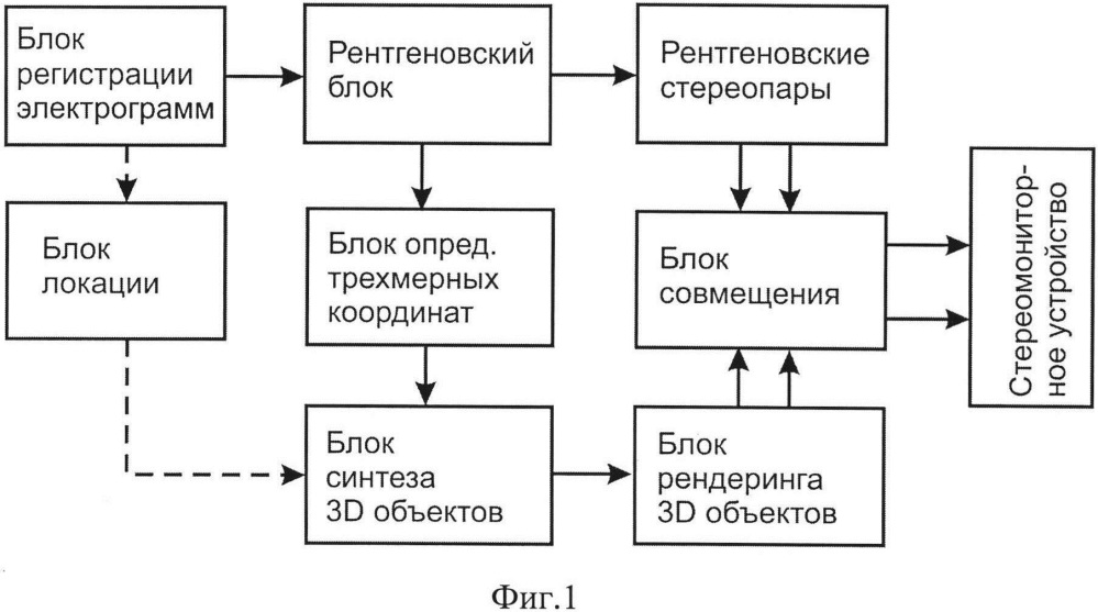 Способ и устройство визуализации в кардиохирургии (патент 2607948)