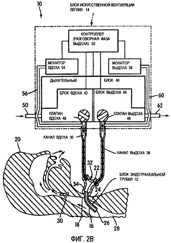 Обнаружение отклонений в системе искусственной вентиляции легких в режиме разговора (патент 2455030)