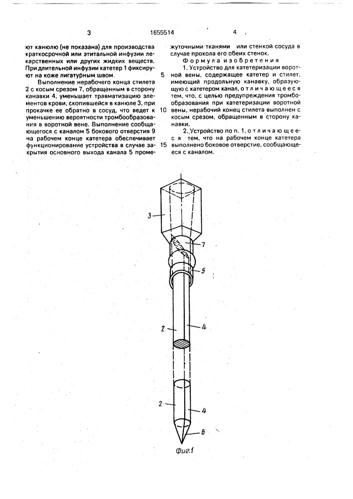 Устройство для катетеризации воротной вены (патент 1655514)