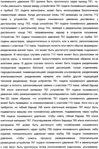 Устройство для лечения путем подкожной подачи пониженного давления с использованием текучей магистрали и связанный с ним способ (патент 2405459)