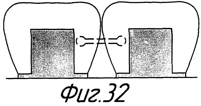 Способ шинирования зубов (варианты) и устройство для его осуществления (патент 2276971)