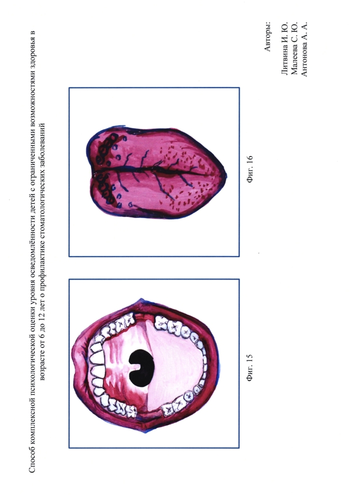 Способ комплексной психологической оценки уровня осведомлённости детей с ограниченными возможностями здоровья от 6 до 12 лет о профилактике стоматологических заболеваний (патент 2595089)