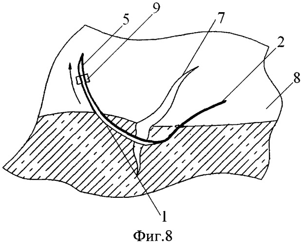 Одноразовая хирургическая игла (патент 2460477)