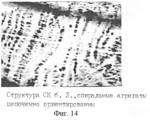 Способ экспресс-диагностики гипер-бета 2-микроглобулинемии (патент 2259565)