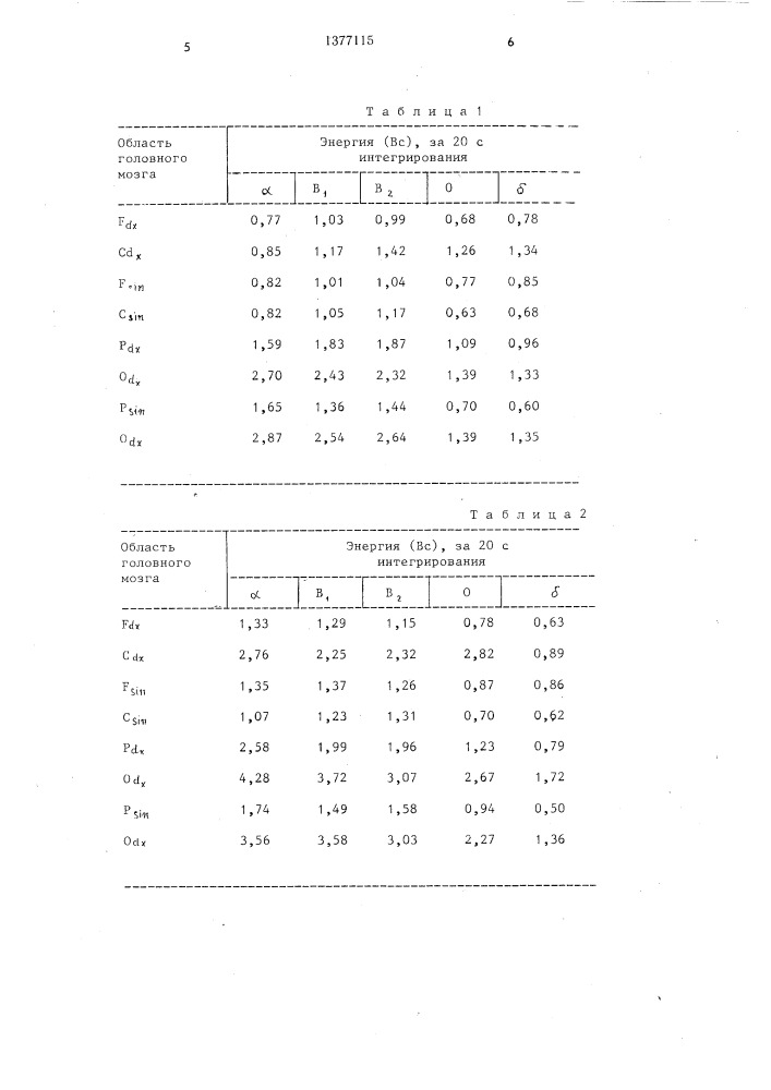 Способ лечения синдрома паркинсонизма (патент 1377115)