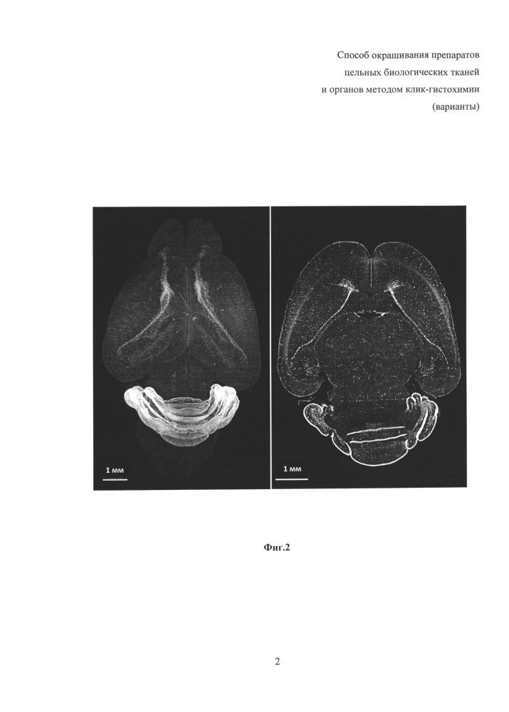 Способ окрашивания препаратов цельных биологических тканей и органов методом клик-гистохимии (варианты) (патент 2620559)