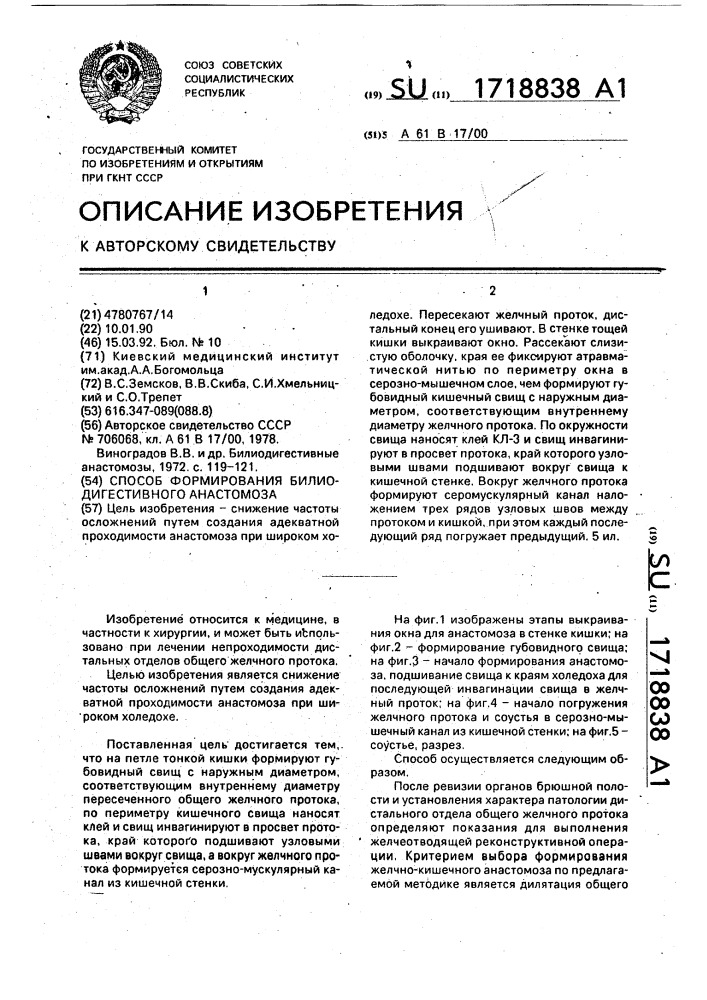 Способ формирования билиодигестивного анастомоза (патент 1718838)