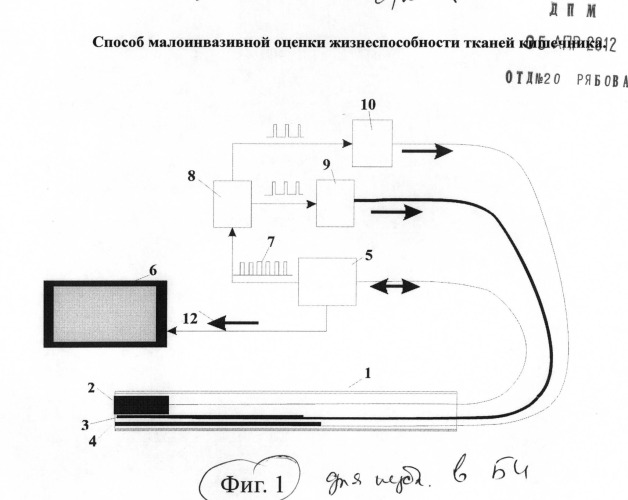 Способ малоинвазивной оценки жизнеспособности кишечника (патент 2496403)