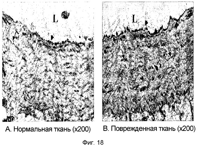 Способ и диагностический набор для измерения количества белка бетта ig-h3 (патент 2281512)