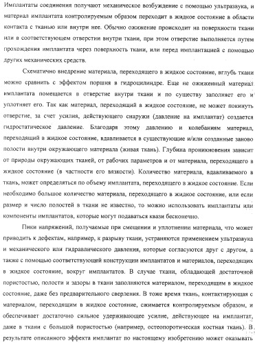Имплантаты для создания соединений с тканями, в частности со скелетом, а также устройство и способ имплантации (патент 2314768)