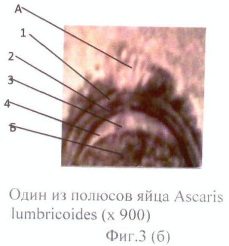 Способ прижизненной дифференциальной диагностики ascaris lumbricoides и ascaris suum по микроструктуре яиц (патент 2464561)