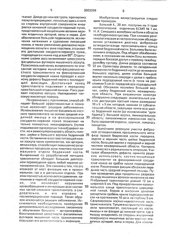 Способ лечения дефекта проксимального отдела бедренной кости (патент 2003298)