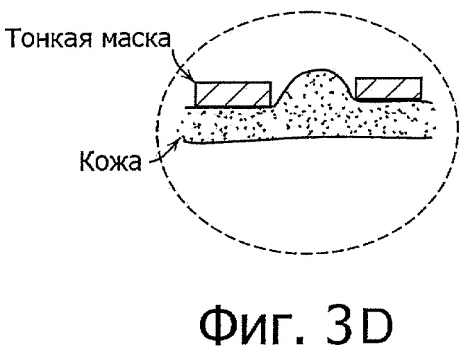 Способ и аппарат для образования нескольких микроканалов (патент 2465848)