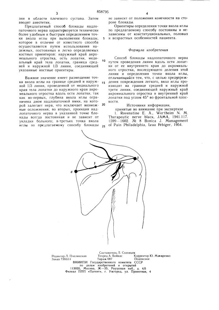 Способ блокады надлопаточного нерва (патент 858795)