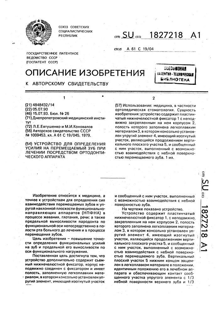 Устройство для определения усилия на перемещаемый зуб при лечении посредством ортодонтического аппарата (патент 1827218)