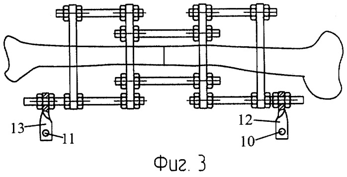 Приставка для чрескостного остеосинтеза у животных (патент 2294713)