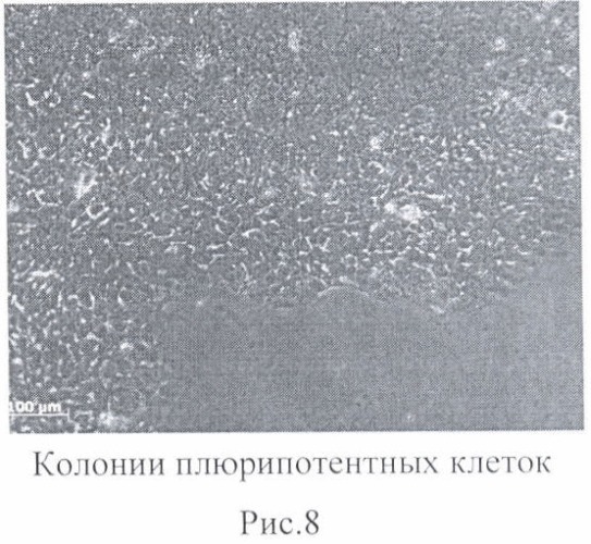 Способ получения плюрипотентных клеток (патент 2399667)