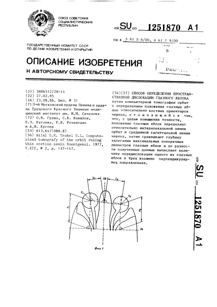 Способ определения пространственной дислокации глазного яблока (патент 1251870)