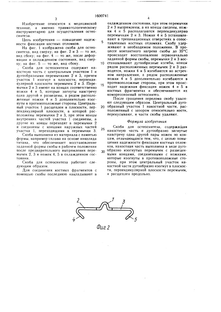 Скоба для остеосинтеза (патент 1600741)