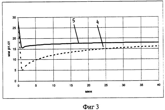 Способ дозированной стабилизации внутриглазного давления во время проведения микроинвазивной непроникающей антиглаукоматозной операции (патент 2320305)