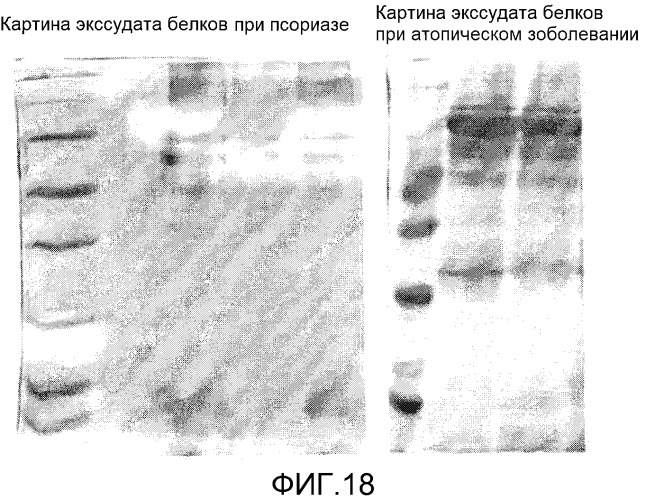 Повязка для лечения кожных заболеваний и облегчения симптомов кожных болезней, вызывающих экссудацию белков крови (патент 2524628)