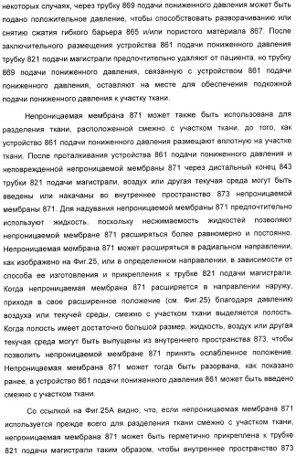 Система и способ продувки устройства пониженного давления во время лечения путем подачи пониженного давления (патент 2404822)