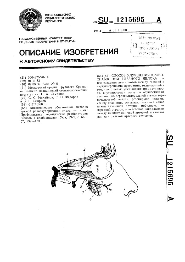 Способ улучшения кровоснабжения глазного яблока (патент 1215695)