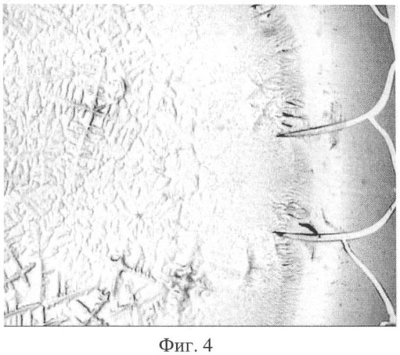 Способ диагностики доклинической стадии склерозирования ткани почек (патент 2410015)