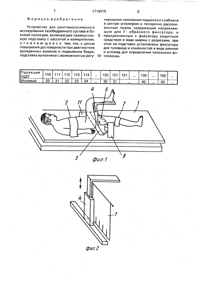 Устройство для рентгенологического исследования тазобедренного сустава в боковой проекции (патент 1718978)