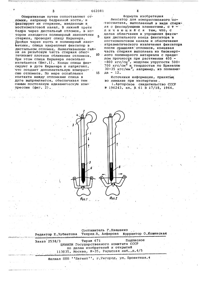 Фиксатор для компрессионного остеосинтеза (патент 662081)