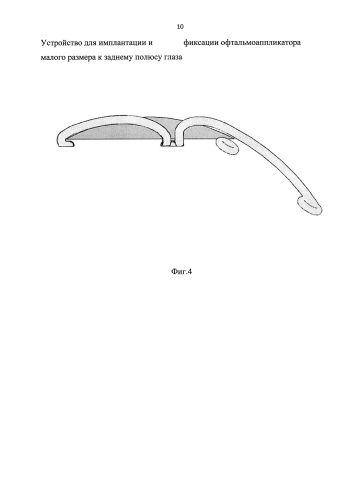 Устройство для имплантации и фиксации офтальмоаппликатора малого размера к заднему полюсу глаза (патент 2591657)