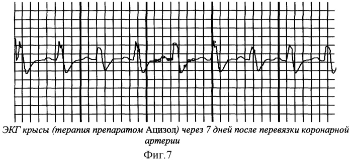 Коронароактивное антиишемическое и антиаритмическое средство (патент 2290927)