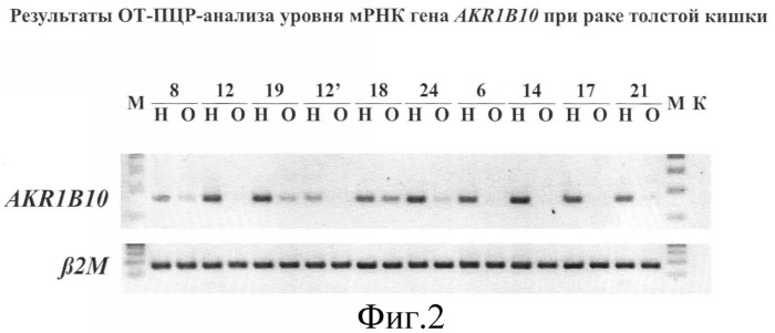 Способ диагностики рака толстой кишки и набор для его осуществления (патент 2374647)