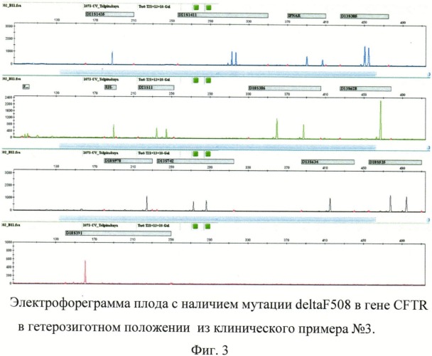 Способ пренатальной и постнатальной днк-диагностики синдрома дауна, эдвардса, патау, мутации delf508 в гене муковисцидоза и резус-фактора плода (патент 2539778)