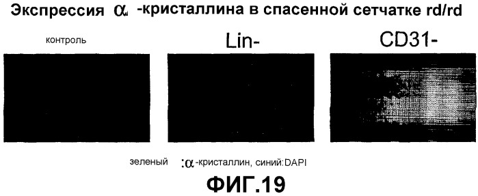 Гематопоэтические стволовые клетки и способы лечения неоваскулярных заболеваний глаз с их помощью (патент 2345780)