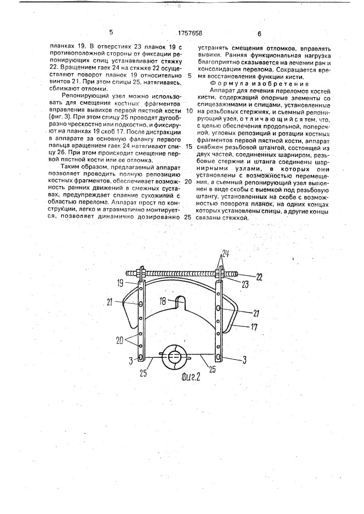 Аппарат для лечения переломов костей кисти (патент 1757658)