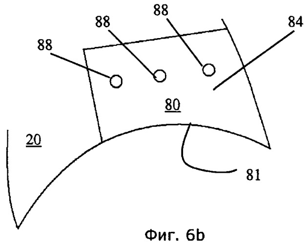 Устройство и способ для лечения бедренно-вертлужного соударения (патент 2506928)