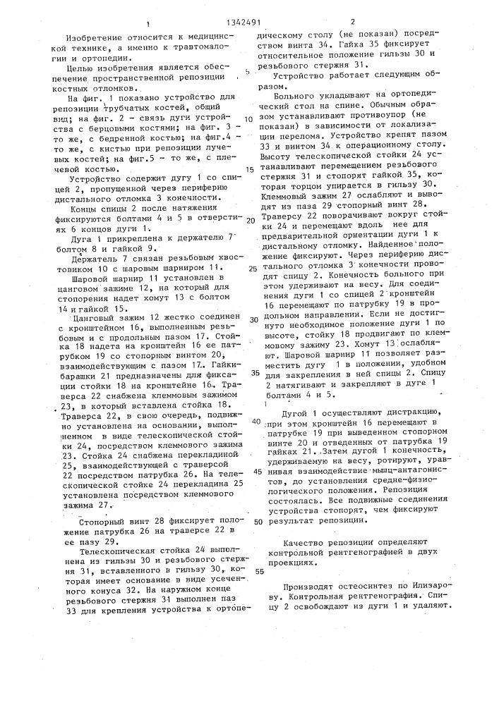 Устройство для сопоставления фрагментов при переломах трубчатых костей (патент 1342491)