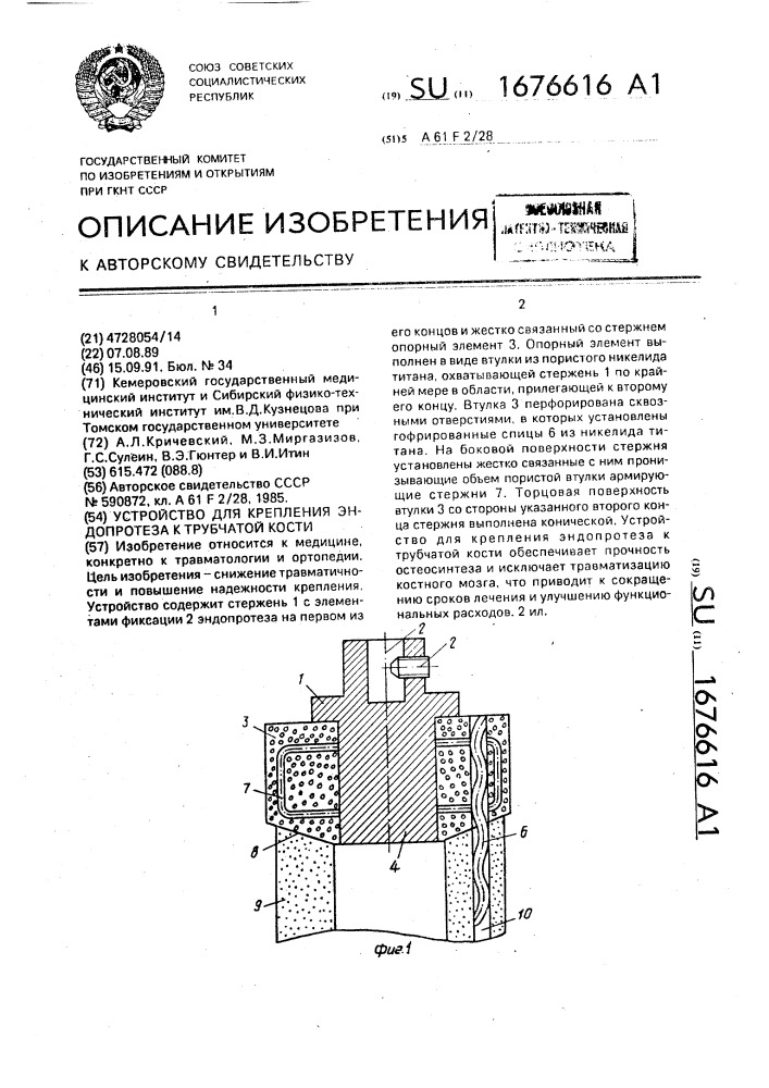 Устройство для крепления эндопротеза к трубчатой кости (патент 1676616)