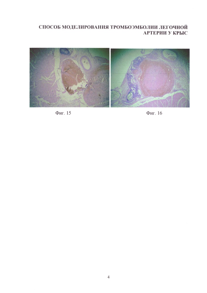 Способ моделирования тромбоэмболии легочной артерии у крыс (патент 2610212)