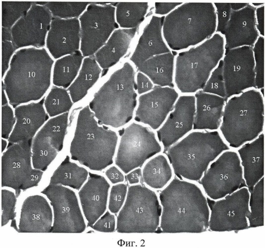 Способ количественной оценки нейрогенных изменений волокон скелетных мышц (патент 2483305)
