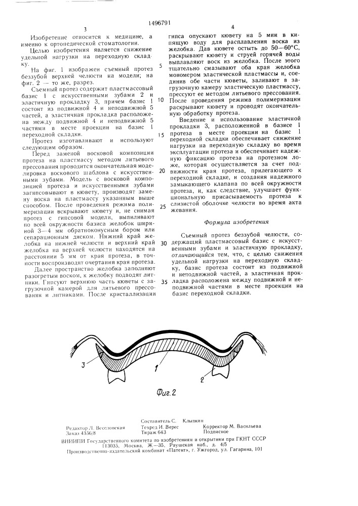 Съемный протез беззубой челюсти (патент 1496791)