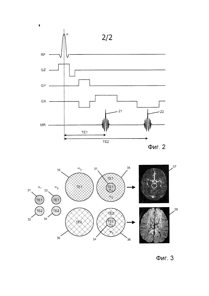 Быстрое формирование магнитно-резонансного изображения с двойной контрастностью (патент 2603598)