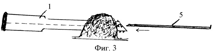 Способ пункционной морфологической диагностики опухоли кожи и мягких тканей (патент 2408285)