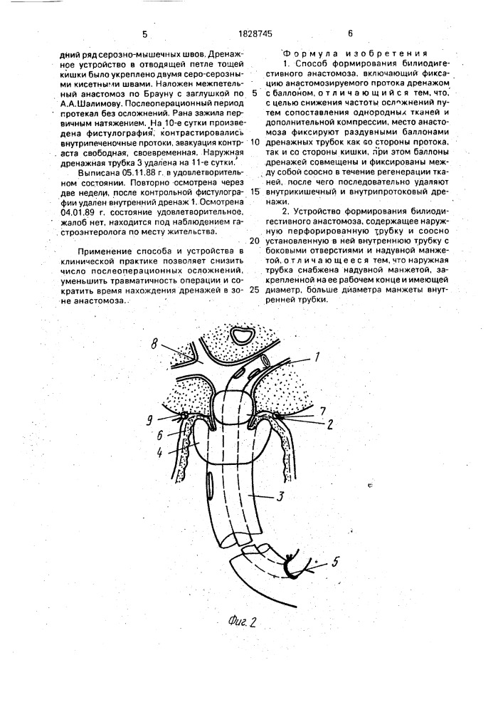 Способ формирования билиодигестивного анастомоза и устройство для его осуществления (патент 1828745)