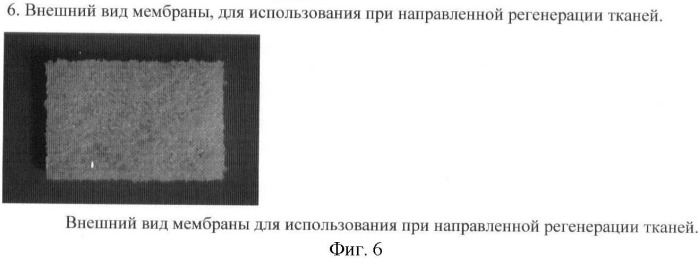 Мембрана для использования при направленной регенерации тканей (патент 2367475)